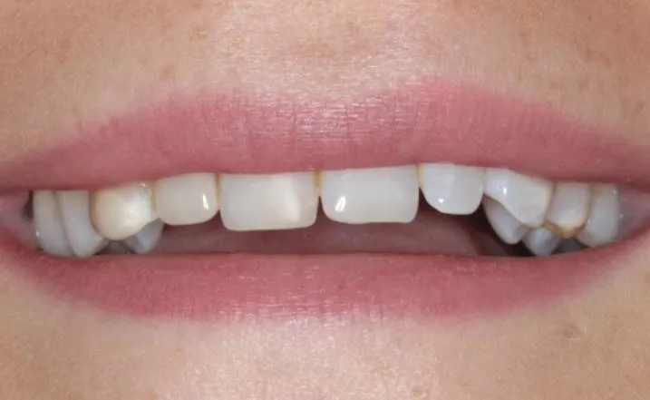 smile transformation widnes dentist